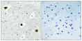 Tumor Protein D52 antibody, abx013543, Abbexa, Western Blot image 