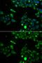 Ubiquinol-Cytochrome C Reductase, Rieske Iron-Sulfur Polypeptide 1 antibody, GTX33574, GeneTex, Immunocytochemistry image 