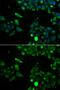 Ubiquinol-Cytochrome C Reductase, Rieske Iron-Sulfur Polypeptide 1 antibody, GTX33574, GeneTex, Immunocytochemistry image 