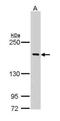 BCR Activator Of RhoGEF And GTPase antibody, GTX111591, GeneTex, Western Blot image 