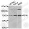 Replication Protein A1 antibody, A0990, ABclonal Technology, Western Blot image 