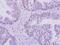 Tumor suppressor p53-binding protein 1 antibody, PA5-34675, Invitrogen Antibodies, Immunohistochemistry paraffin image 