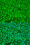 PNKD Metallo-Beta-Lactamase Domain Containing antibody, 23-460, ProSci, Immunofluorescence image 