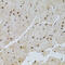 Protein Phosphatase 2 Regulatory Subunit B'Gamma antibody, 19-690, ProSci, Immunohistochemistry paraffin image 