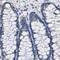 Asialoglycoprotein Receptor 1 antibody, PA5-52885, Invitrogen Antibodies, Immunohistochemistry paraffin image 