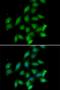 Protein Phosphatase 2 Catalytic Subunit Alpha antibody, LS-C334893, Lifespan Biosciences, Immunofluorescence image 