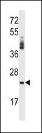 Serine Protease 2 antibody, LS-C162191, Lifespan Biosciences, Western Blot image 
