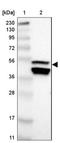 Secretin Receptor antibody, NBP1-86125, Novus Biologicals, Western Blot image 