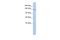 Transmembrane Protein 132B antibody, A16132, Boster Biological Technology, Western Blot image 