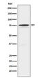 Forkhead Box O1 antibody, M00073-1, Boster Biological Technology, Western Blot image 