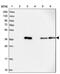 ALG2 Alpha-1,3/1,6-Mannosyltransferase antibody, PA5-59643, Invitrogen Antibodies, Western Blot image 