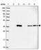 ALG2 Alpha-1,3/1,6-Mannosyltransferase antibody, PA5-59643, Invitrogen Antibodies, Western Blot image 