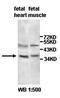 Acyl-CoA Binding Domain Containing 6 antibody, orb77485, Biorbyt, Western Blot image 