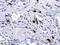 Carboxypeptidase B2 antibody, PB9997, Boster Biological Technology, Immunohistochemistry paraffin image 