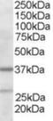 Actin Related Protein 2/3 Complex Subunit 1B antibody, NB300-898, Novus Biologicals, Immunohistochemistry frozen image 