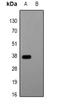 Glu-Glu tag antibody, LS-C368989, Lifespan Biosciences, Western Blot image 