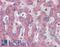 c-met antibody, LS-B3345, Lifespan Biosciences, Immunohistochemistry paraffin image 