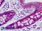 Histidyl-TRNA Synthetase antibody, LS-B9136, Lifespan Biosciences, Immunohistochemistry paraffin image 