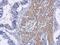 Receptor Interacting Serine/Threonine Kinase 2 antibody, GTX113044, GeneTex, Immunohistochemistry paraffin image 