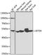 SET Domain Containing 6, Protein Lysine Methyltransferase antibody, A08952, Boster Biological Technology, Western Blot image 