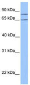 3-Oxoacid CoA-Transferase 2 antibody, TA346817, Origene, Western Blot image 