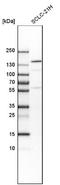 Tetratricopeptide Repeat Domain 21B antibody, NBP1-90416, Novus Biologicals, Western Blot image 