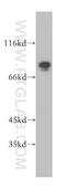 Mitotic spindle assembly checkpoint protein MAD1 antibody, 18322-1-AP, Proteintech Group, Western Blot image 