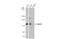 SMCR8-C9orf72 Complex Subunit antibody, GTX134771, GeneTex, Western Blot image 