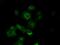 Tubulin Alpha 8 antibody, GTX83463, GeneTex, Immunocytochemistry image 