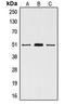Vitamin D Receptor antibody, LS-C352989, Lifespan Biosciences, Western Blot image 
