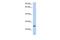 Tetratricopeptide Repeat Domain 9C antibody, GTX45218, GeneTex, Western Blot image 