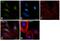 Coactivator Associated Arginine Methyltransferase 1 antibody, MA5-15796, Invitrogen Antibodies, Immunofluorescence image 