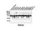 Phosphodiesterase 3A antibody, LS-C82362, Lifespan Biosciences, Western Blot image 