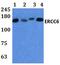 ERCC Excision Repair 6, Chromatin Remodeling Factor antibody, PA5-75849, Invitrogen Antibodies, Western Blot image 