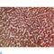 Angiogenin antibody, LS-C813771, Lifespan Biosciences, Immunohistochemistry paraffin image 