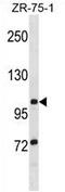 Tubulin Tyrosine Ligase Like 8 antibody, AP54411PU-N, Origene, Western Blot image 