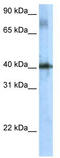 TSC22 Domain Family Member 4 antibody, TA329926, Origene, Western Blot image 