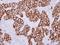 Keratin-5 antibody, NBP2-17038, Novus Biologicals, Immunohistochemistry frozen image 