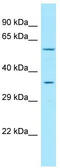 G Protein-Coupled Receptor 35 antibody, TA338287, Origene, Western Blot image 