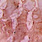 TNNI3 Interacting Kinase antibody, LS-C358369, Lifespan Biosciences, Immunohistochemistry paraffin image 