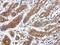 Carcinoembryonic Antigen Related Cell Adhesion Molecule 21 antibody, NBP2-15853, Novus Biologicals, Immunohistochemistry paraffin image 