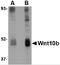 Wnt Family Member 10B antibody, 4619, ProSci, Western Blot image 