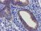 Schlafen Like 1 antibody, LS-C172417, Lifespan Biosciences, Immunohistochemistry paraffin image 