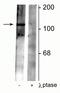 Gamma-Aminobutyric Acid Type B Receptor Subunit 2 antibody, P03830, Boster Biological Technology, Western Blot image 