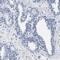 Leucine Rich Repeats And WD Repeat Domain Containing 1 antibody, PA5-54380, Invitrogen Antibodies, Immunohistochemistry paraffin image 