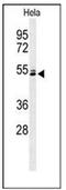 Keratin 78 antibody, AP52287PU-N, Origene, Western Blot image 