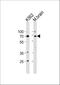 Tumor Protein P73 antibody, A00688-1, Boster Biological Technology, Western Blot image 