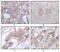 Serine/Threonine/Tyrosine Kinase 1 antibody, MA5-15372, Invitrogen Antibodies, Immunohistochemistry paraffin image 