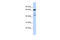 Scm Polycomb Group Protein Like 4 antibody, 25-211, ProSci, Western Blot image 