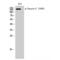 Tensin 2 antibody, LS-C380857, Lifespan Biosciences, Western Blot image 